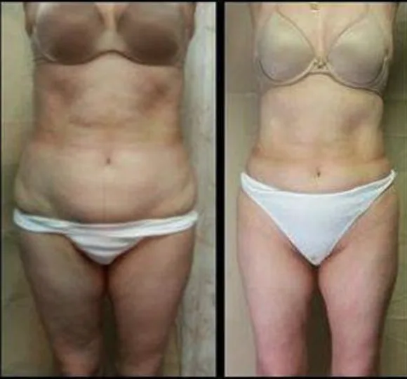 3-week transformation results