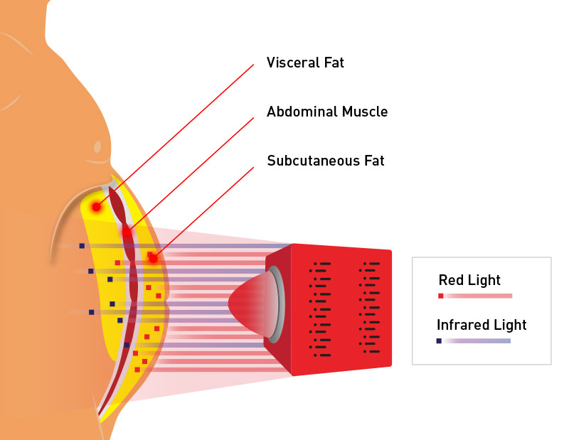 Illustration of how red light therapy targets subcutaneous fat in the abdomen
